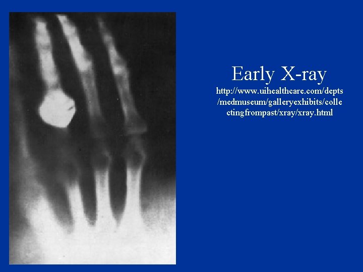 Early X-ray http: //www. uihealthcare. com/depts /medmuseum/galleryexhibits/colle ctingfrompast/xray. html 
