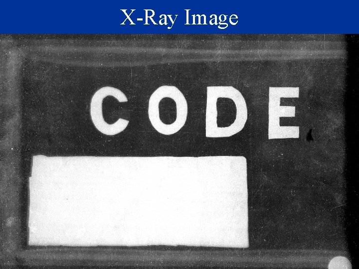 X-Ray Image 