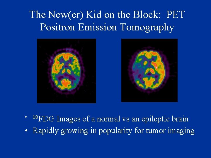 The New(er) Kid on the Block: PET Positron Emission Tomography • 18 FDG Images