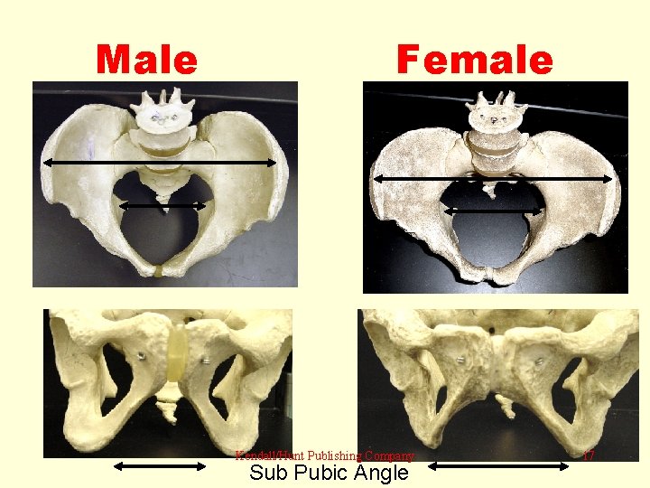 Male Female Kendall/Hunt Publishing Company Sub Pubic Angle 17 