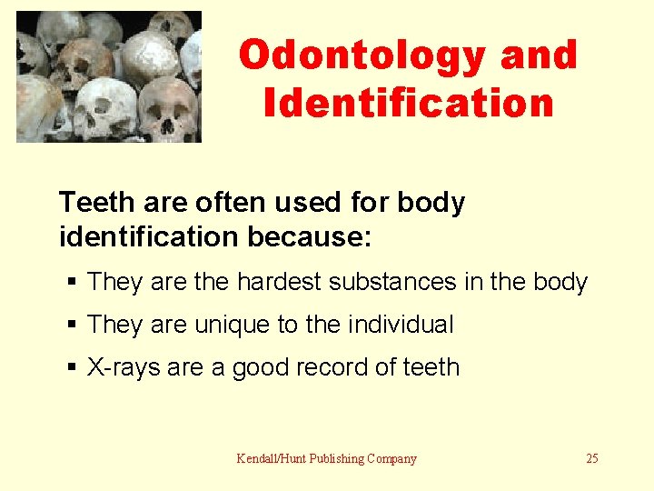 Odontology and Identification Teeth are often used for body identification because: § They are