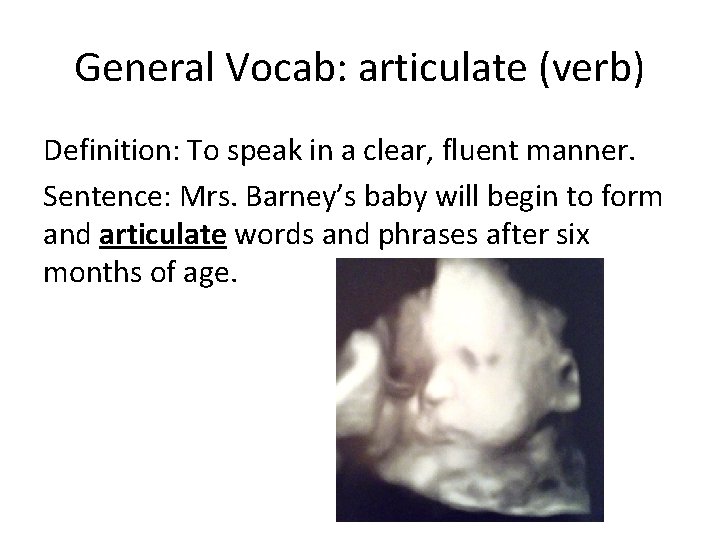 General Vocab: articulate (verb) Definition: To speak in a clear, fluent manner. Sentence: Mrs. General Vocab: articulate (verb) Definition: To speak in a clear, fluent manner. Sentence: Mrs.