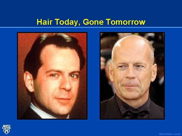 Hair Today, Gone Tomorrow © 2012 MFMER | slide-26 