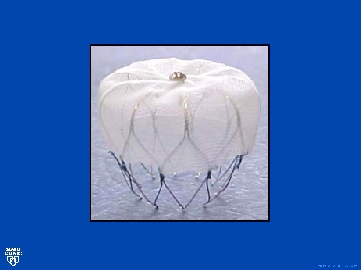 © 2012 MFMER | slide-12 