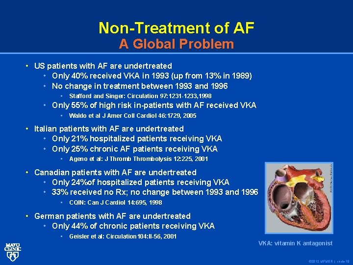 Non-Treatment of AF A Global Problem • US patients with AF are undertreated •