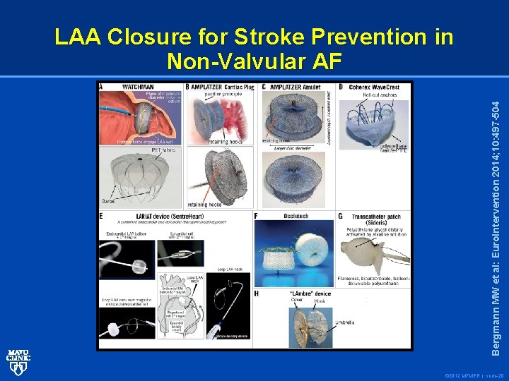 Bergmann MW et al: Euro. Intervention 2014; 10: 497 -504 LAA Closure for Stroke