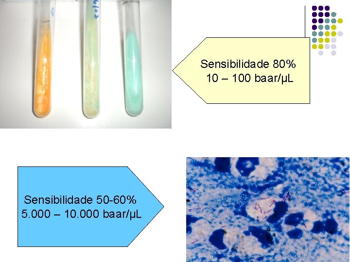 Sensibilidade 80% 10 – 100 baar/µL Sensibilidade 50 -60% 5. 000 – 10. 000