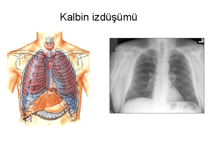 Kalbin izdüşümü Kalbin izdüşümü