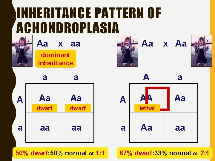 INHERITANCE PATTERN OF ACHONDROPLASIA Aa x aa Aa x Aa dominant inheritance A a