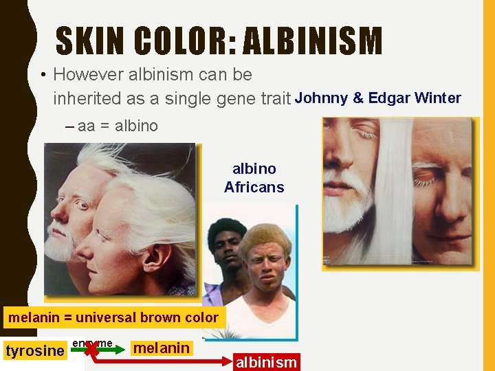 SKIN COLOR: ALBINISM • However albinism can be inherited as a single gene trait
