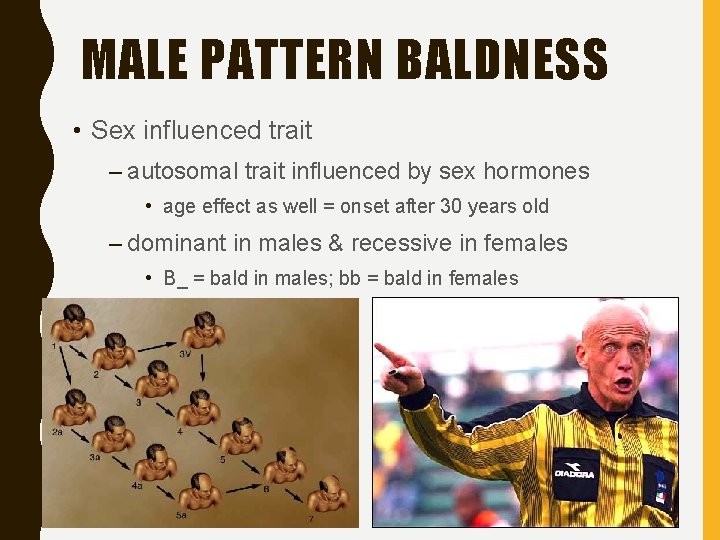 MALE PATTERN BALDNESS • Sex influenced trait – autosomal trait influenced by sex hormones
