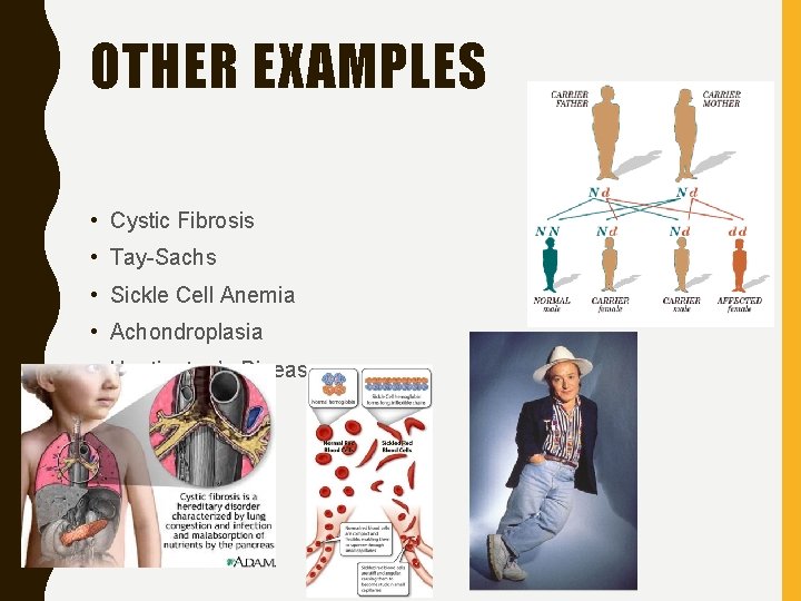 OTHER EXAMPLES • Cystic Fibrosis • Tay-Sachs • Sickle Cell Anemia • Achondroplasia •