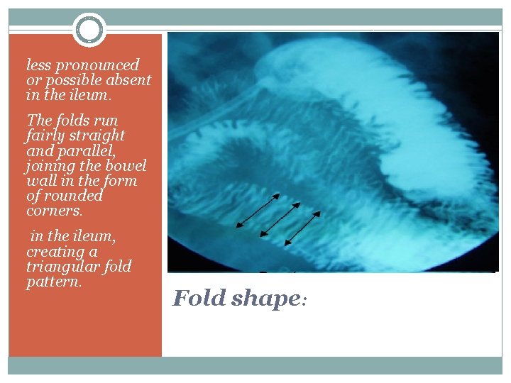 less pronounced or possible absent in the ileum. The folds run fairly straight and