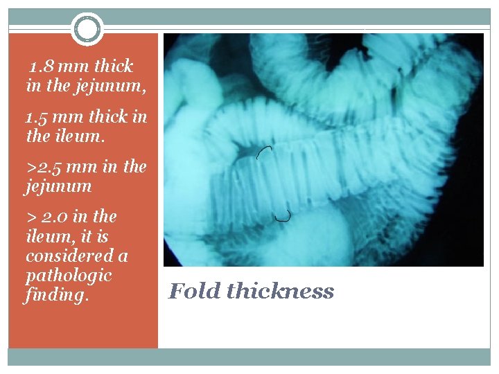 1. 8 mm thick in the jejunum, 1. 5 mm thick in the ileum.
