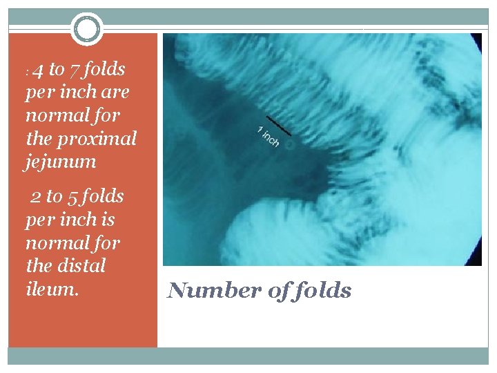 4 to 7 folds per inch are normal for the proximal jejunum : 2