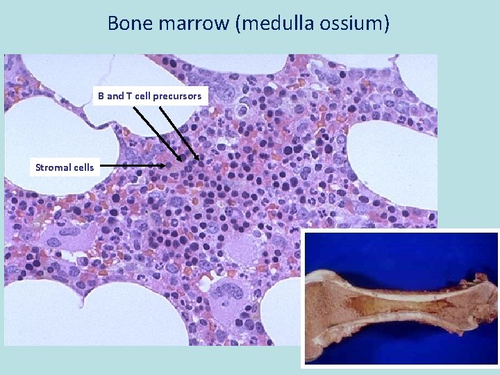 Bone marrow (medulla ossium) B and T cell precursors Stromal cells 