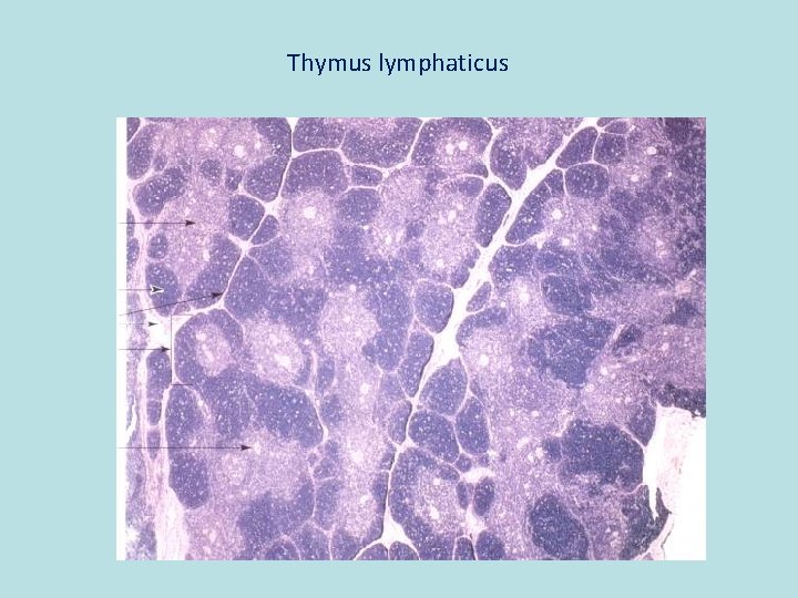 Thymus lymphaticus 