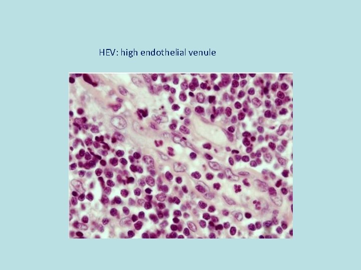 HEV: high endothelial venule 