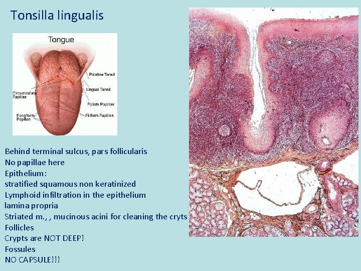 Tonsilla lingualis Behind terminal sulcus, pars follicularis No papillae here Epithelium: stratified squamous non