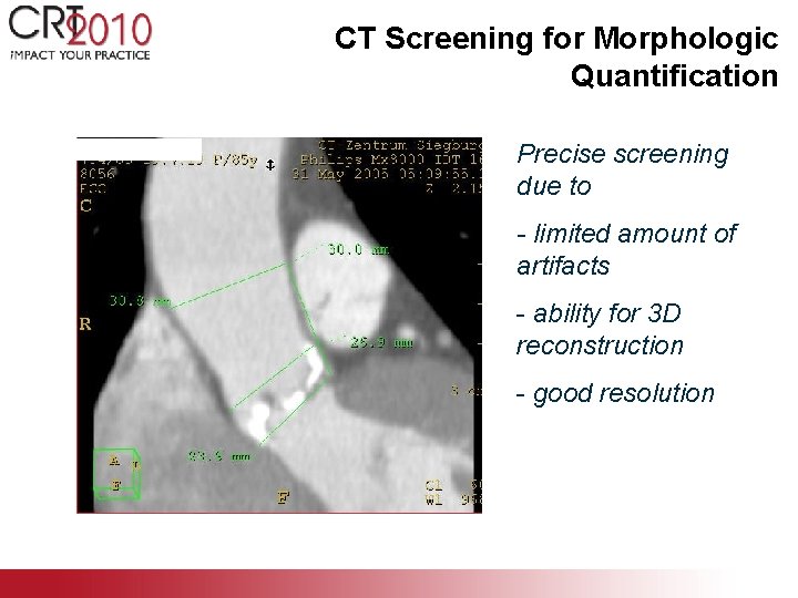 CT Screening for Morphologic Quantification Precise screening due to - limited amount of artifacts