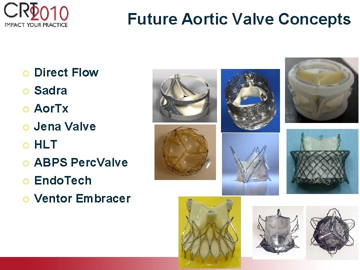 Future Aortic Valve Concepts ¡ Direct Flow ¡ Sadra ¡ Aor. Tx ¡ Jena