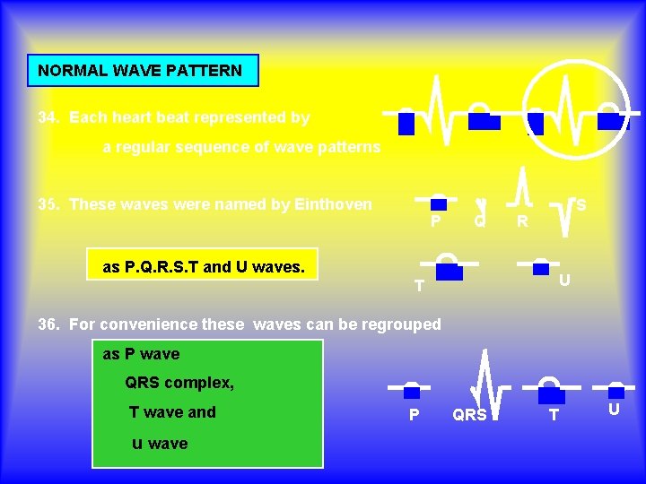 NORMAL WAVE PATTERN 34. Each heart beat represented by a regular sequence of wave