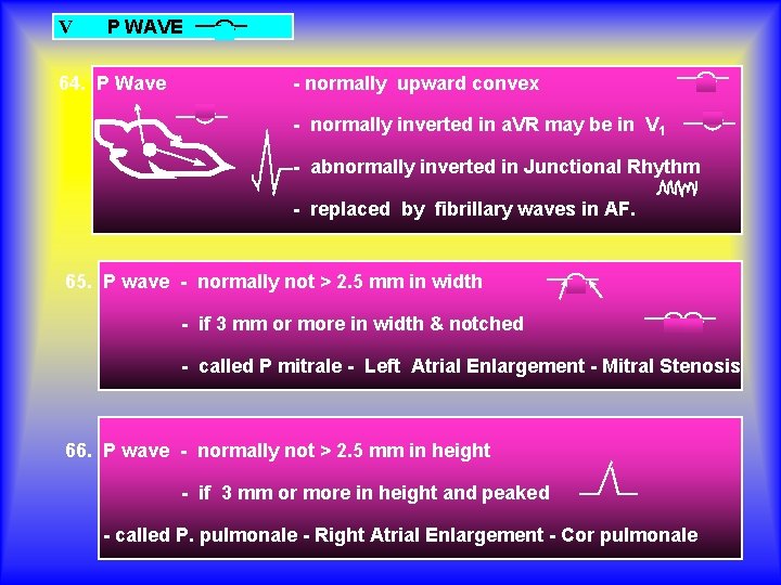 V P WAVE 64. P Wave - normally upward convex - normally inverted in