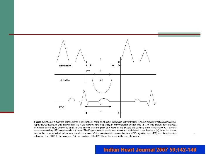 Indian Heart Journal 2007 59; 142 -146 