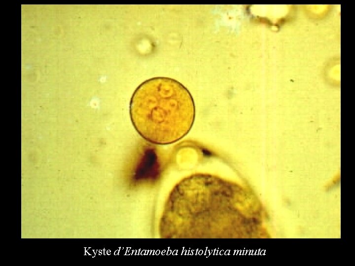 Kyste d’Entamoeba histolytica minuta 