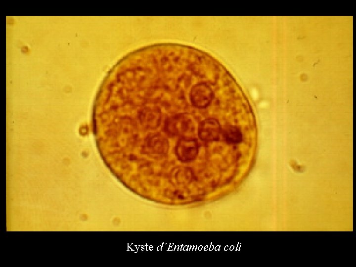 Kyste d’Entamoeba coli 