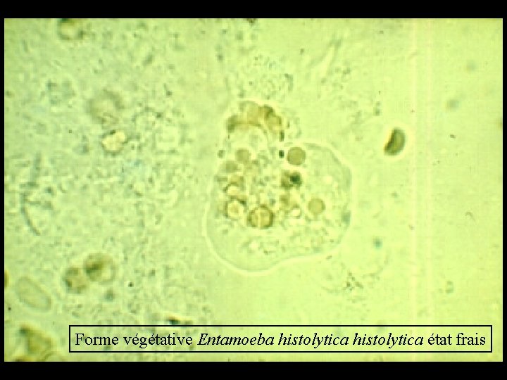 Forme végétative Entamoeba histolytica état frais 