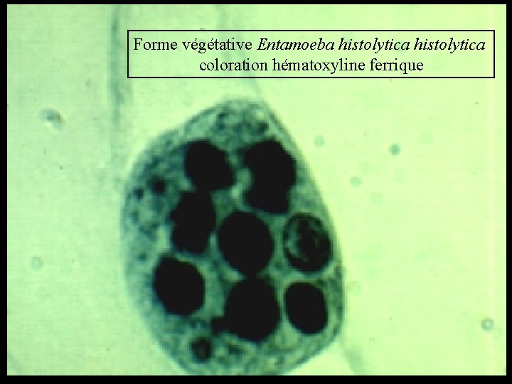 Forme végétative Entamoeba histolytica coloration hématoxyline ferrique 