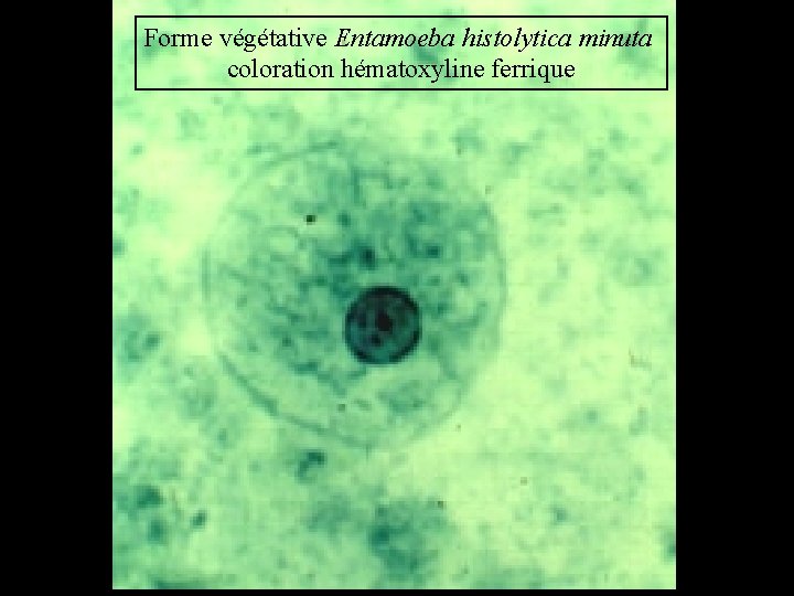 Forme végétative Entamoeba histolytica minuta coloration hématoxyline ferrique 
