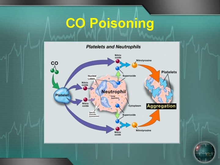 CO Poisoning 