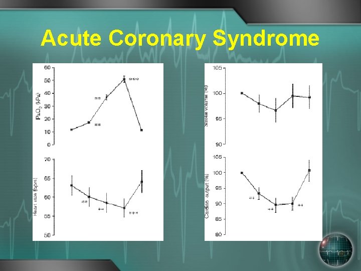 Acute Coronary Syndrome 