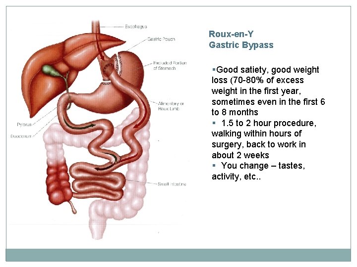 Roux-en-Y Gastric Bypass §Good satiety, good weight loss (70 -80% of excess weight in