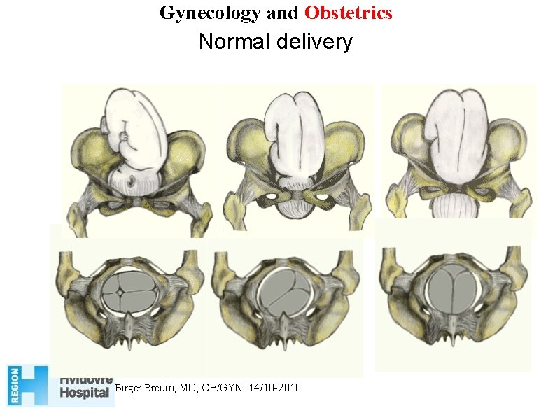 Gynecology and Obstetrics Normal delivery Birger Breum, MD, OB/GYN. 14/10 -2010 