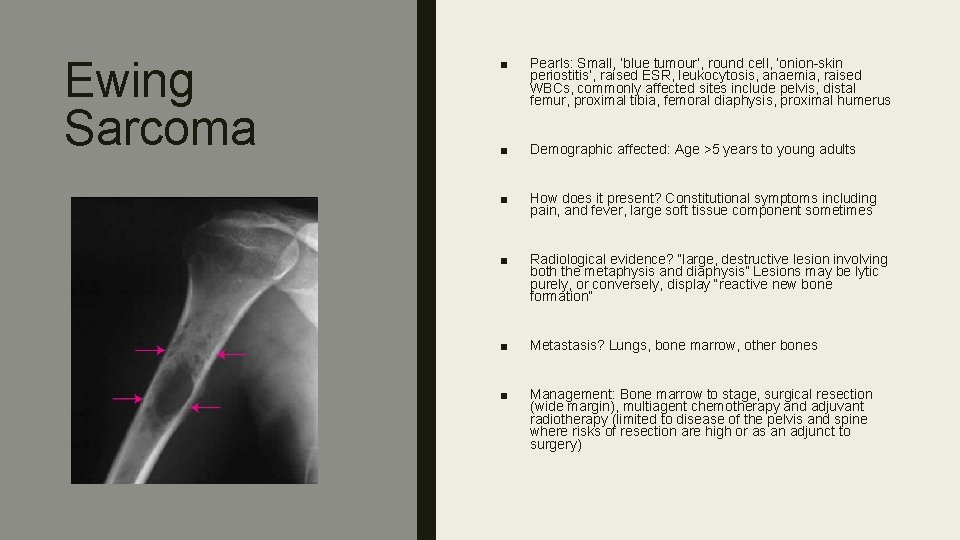 Ewing Sarcoma ■ Pearls: Small, ‘blue tumour’, round cell, ‘onion-skin periostitis’, raised ESR, leukocytosis,