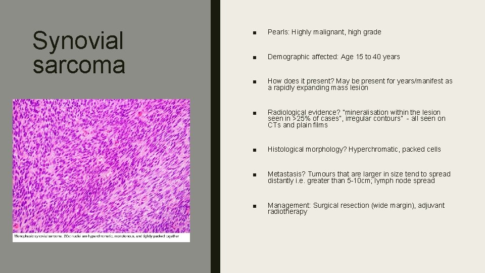 Synovial sarcoma ■ Pearls: Highly malignant, high grade ■ Demographic affected: Age 15 to