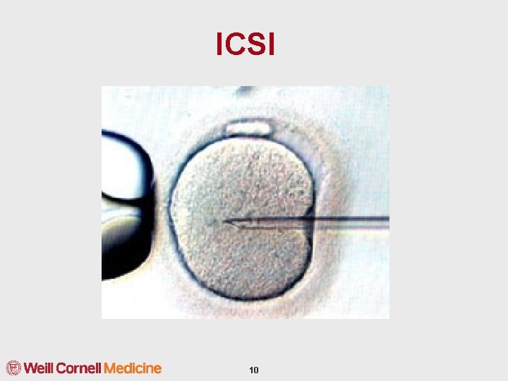 ICSI 10 