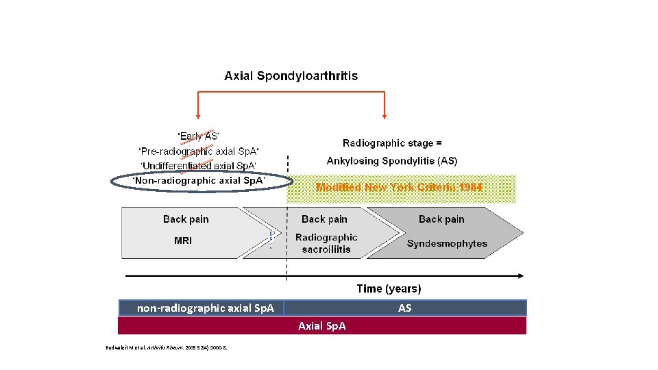 Axial Sp. A ? non-radiographic axial Sp. A AS Axial Sp. A Rudwaleit M