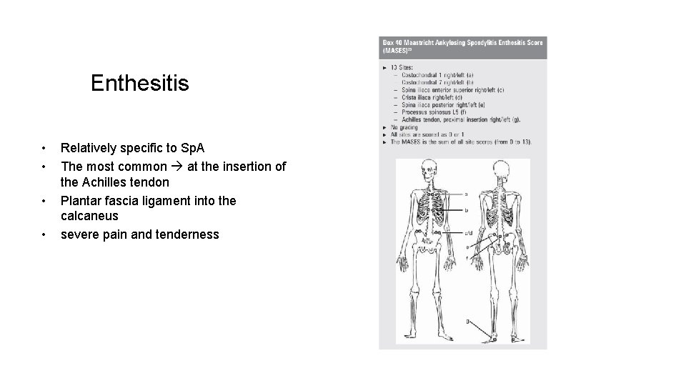 Enthesitis • • Relatively specific to Sp. A The most common at the insertion