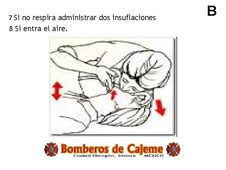 7 Si no respira administrar dos insuflaciones 8 Si entra el aire. B 