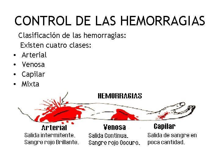 CONTROL DE LAS HEMORRAGIAS • • Clasificación de las hemorragias: Existen cuatro clases: Arterial