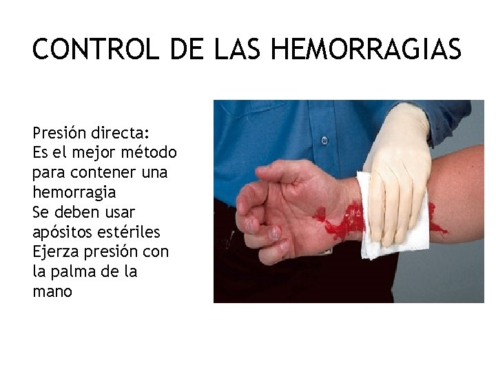 CONTROL DE LAS HEMORRAGIAS Presión directa: Es el mejor método para contener una hemorragia