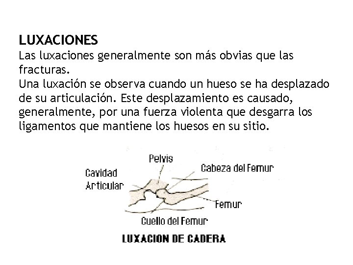 LUXACIONES Las luxaciones generalmente son más obvias que las fracturas. Una luxación se observa