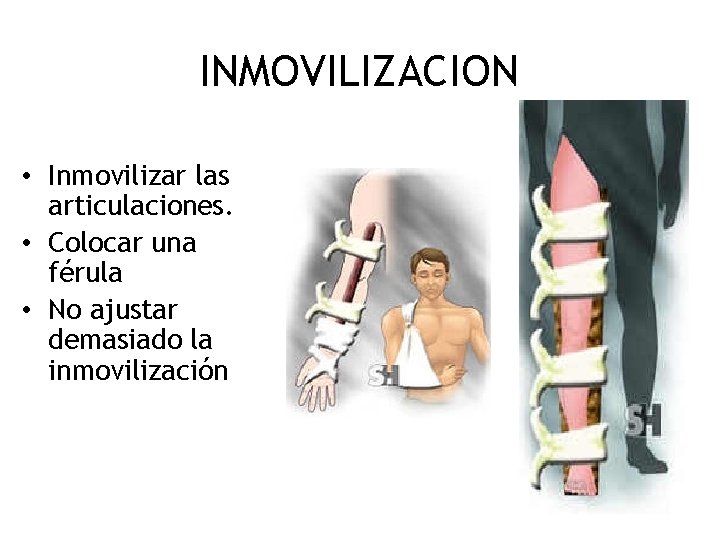 INMOVILIZACION • Inmovilizar las articulaciones. • Colocar una férula • No ajustar demasiado la