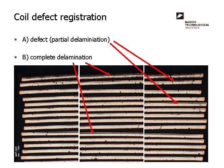 Coil defect registration § A) defect (partial delaminiation) § B) complete delamination 