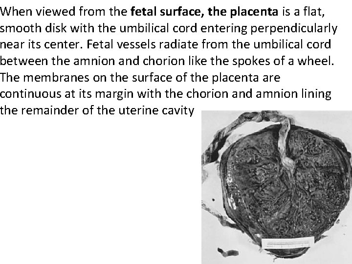 When viewed from the fetal surface, the placenta is a flat, smooth disk with