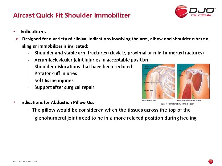 Aircast Quick Fit Shoulder Immobilizer • Indications Ø Designed for a variety of clinical